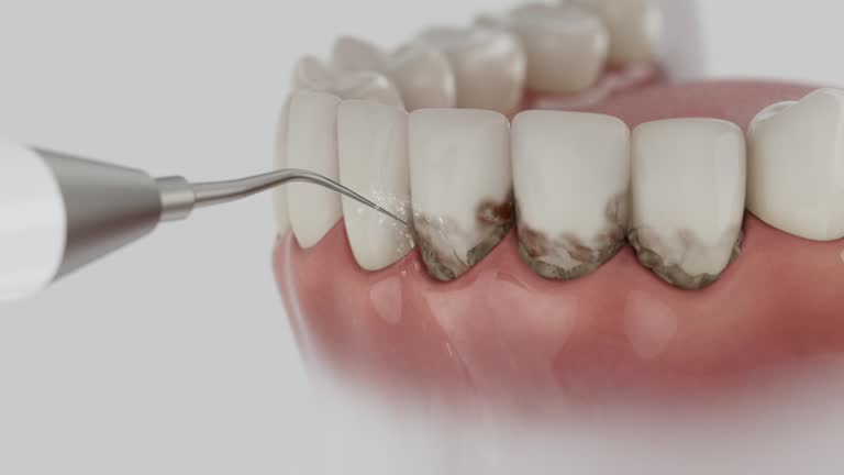 Reliable Teeth Cleaning And Checkup contractor in Madison County County, MS by Dentist Open Now